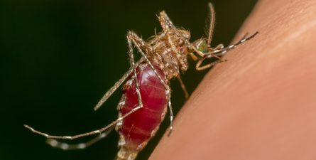 Visceral leishmaniasis